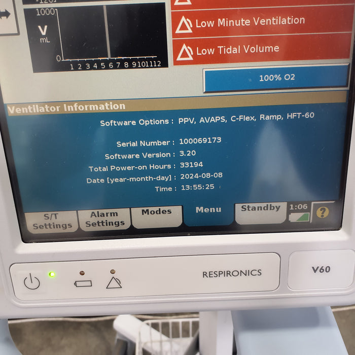 Respironics V60 BiPAP Ventilator