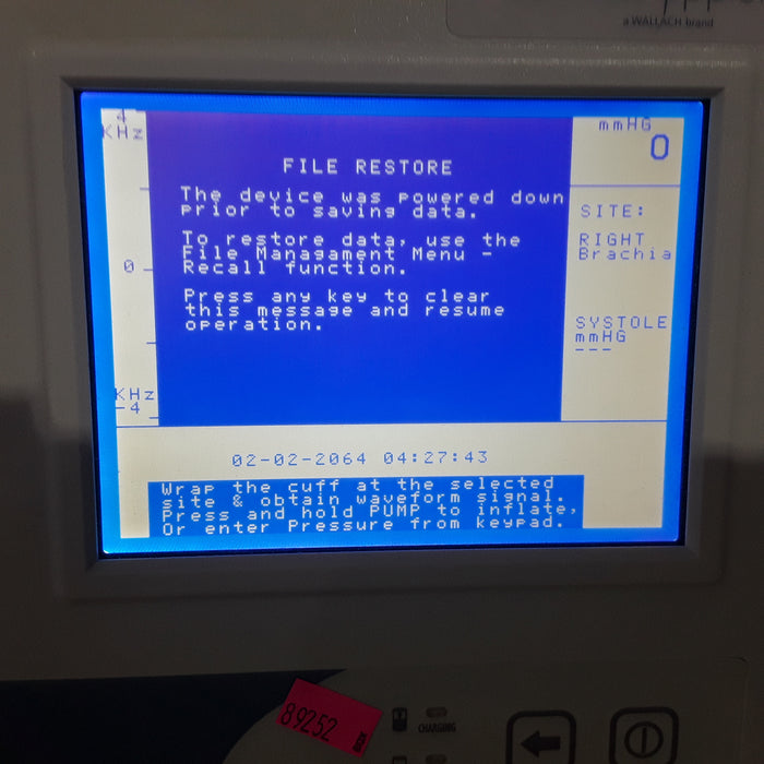 Summit Doppler Vista AVS Advanced Vascular System