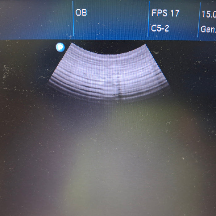 Philips Philips HD3 Ultrasound Ultrasound reLink Medical