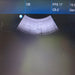 Philips Philips HD3 Ultrasound Ultrasound reLink Medical