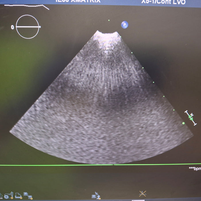 Philips X5-1 Cardiac xMATRIX Sector Array Transducer