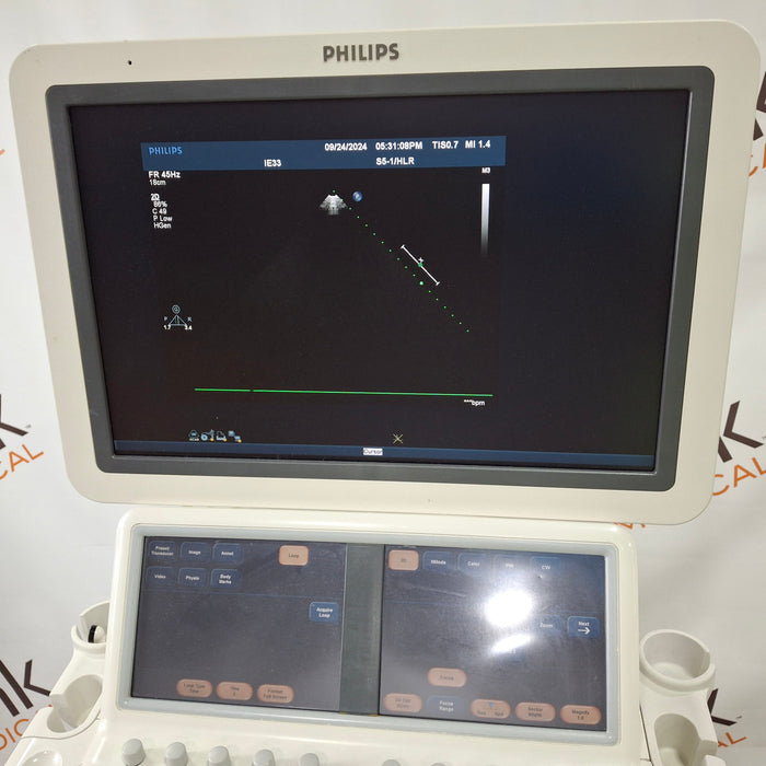 Philips IE33 F-G Cart Ultrasound