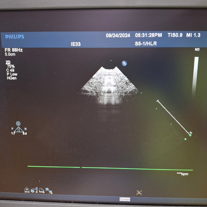 Philips IE33 F-G Cart Ultrasound