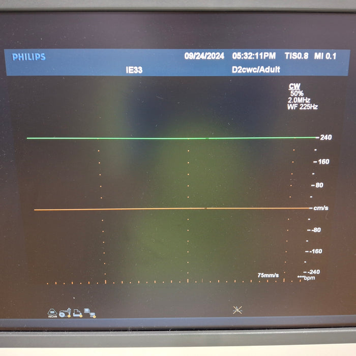 Philips IE33 F-G Cart Ultrasound