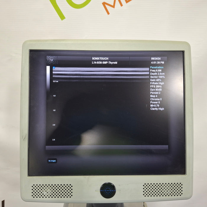 UltraSonix Sonix Touch Ultrasound