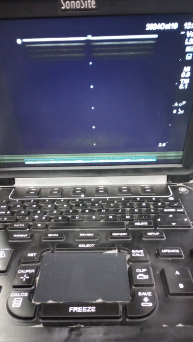 Sonosite Edge Ultrasound