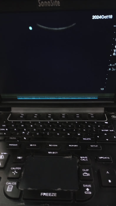 Sonosite Edge Ultrasound