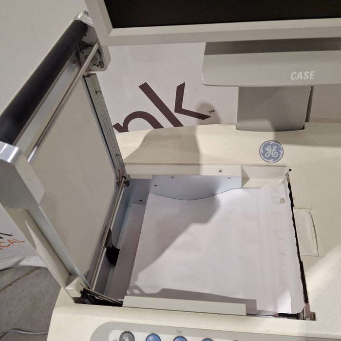 GE Healthcare Case P2 Stress Test Console