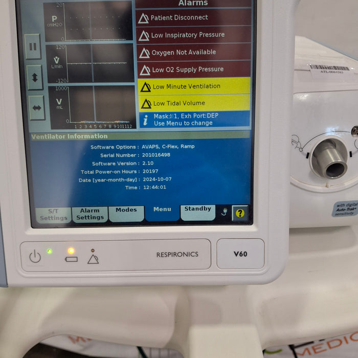 Respironics V60 BiPAP Ventilator