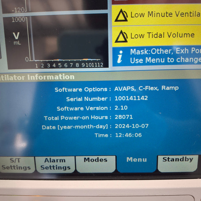 Philips Respironics V60 BiPAP Ventilator