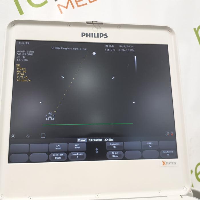 Philips CX50 Ultrasound