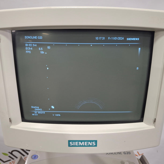 Siemens Sonoline G20 Ultrasound