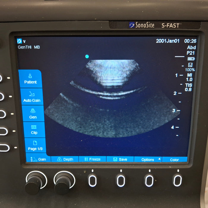 Sonosite Sonosite S-Fast Ultrasound Ultrasound reLink Medical