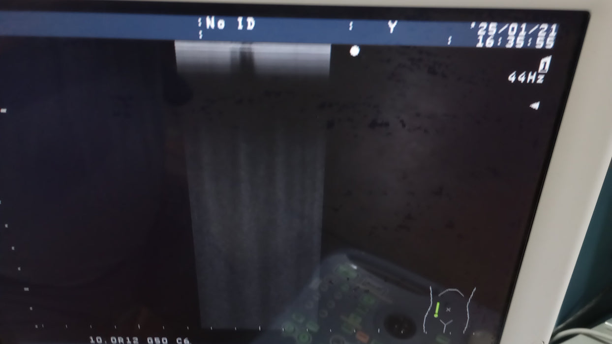 Aloka Prosound 3500 SSD Ultrasound