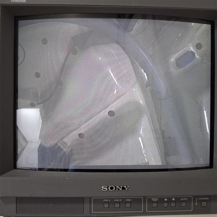 Olympus WA50013A Video Laparoscope