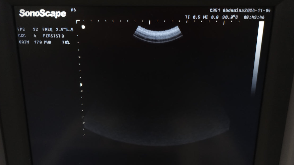 SonoScape Medical Corp SonoScape Medical Corp A6 Portable Doppler Ultrasound Ultrasound reLink Medical