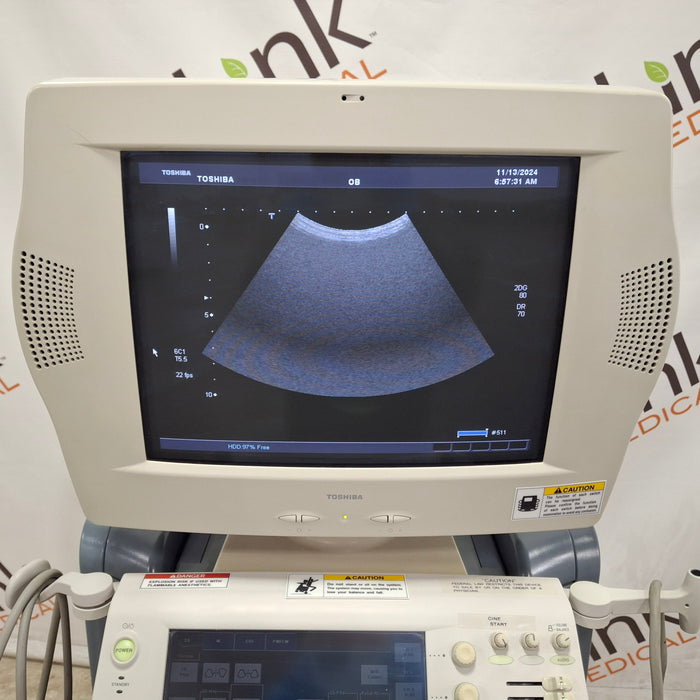 Toshiba Aplio 80 Ultrasound