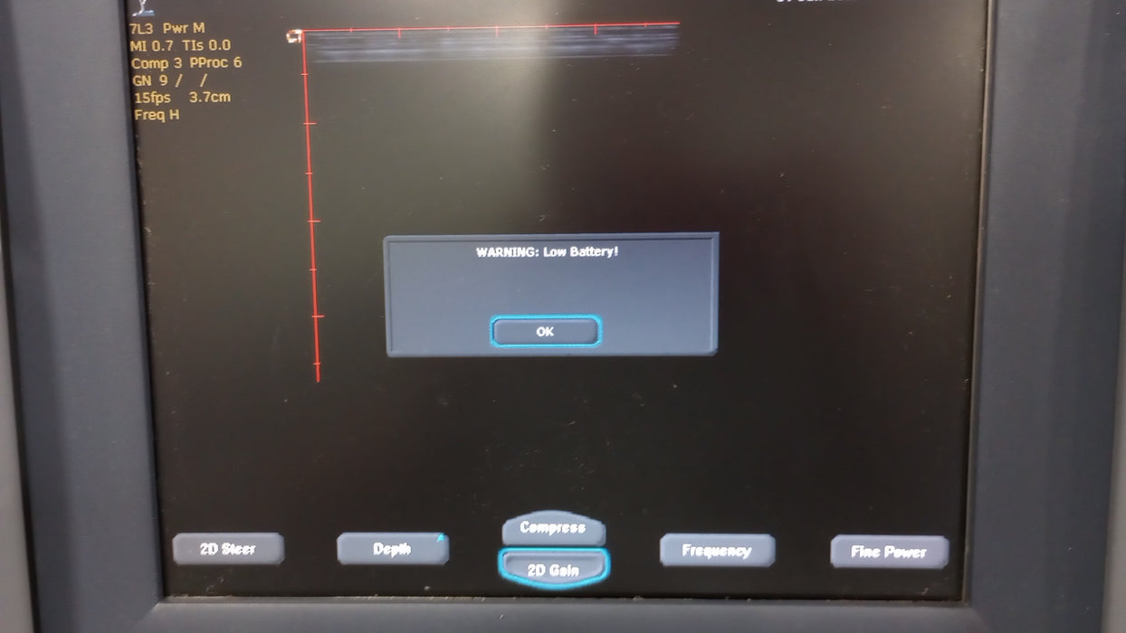 Siemens Cypress Portable Ultrasound