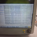 GE Healthcare GE Healthcare Carescape B650 Patient Monitor Patient Monitors reLink Medical