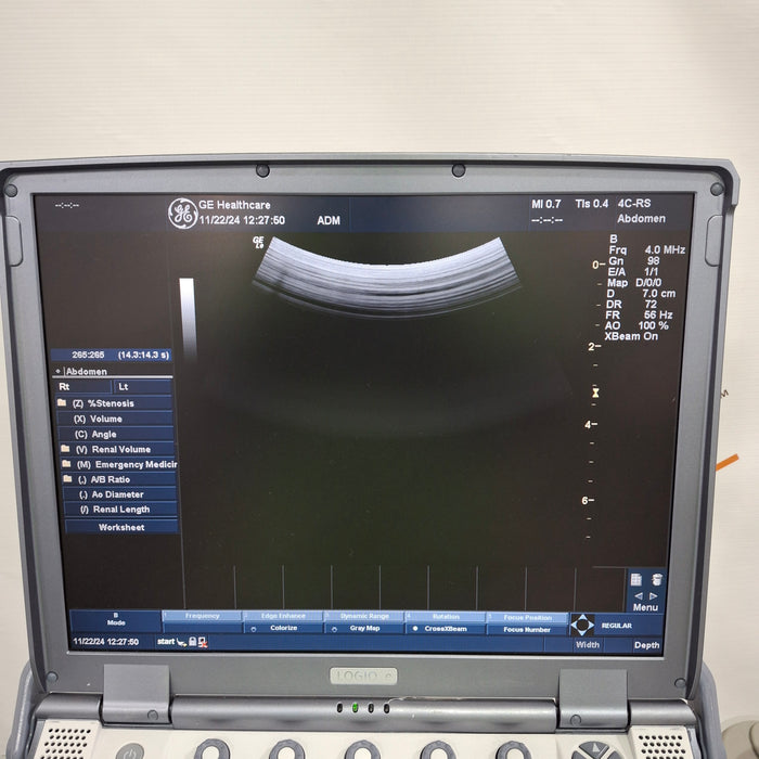 GE Healthcare Logiq e Ultrasound