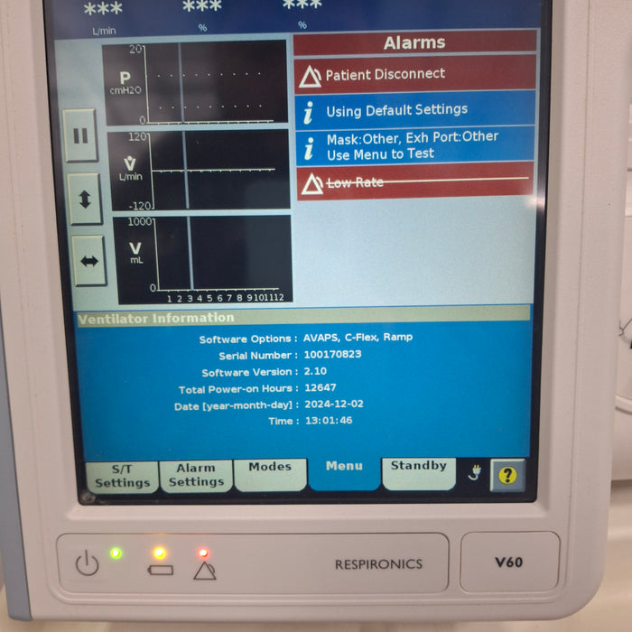 Philips Respironics V60 BiPAP Ventilator