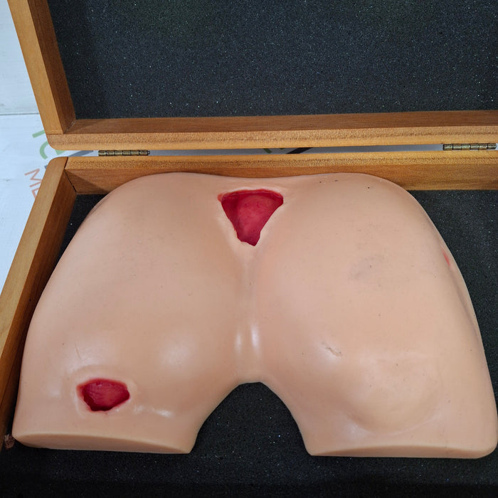 WRS Health EDCO Decubitus Ulcer Model