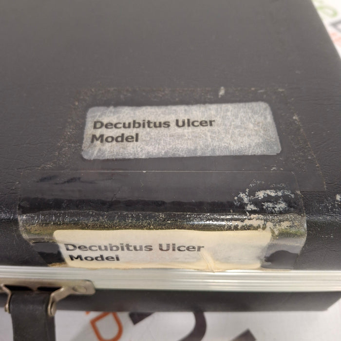 WRS Health EDCO Decubitus Ulcer Model