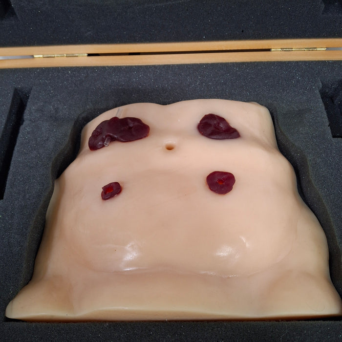 WRS Health EDCO Ostomy Model