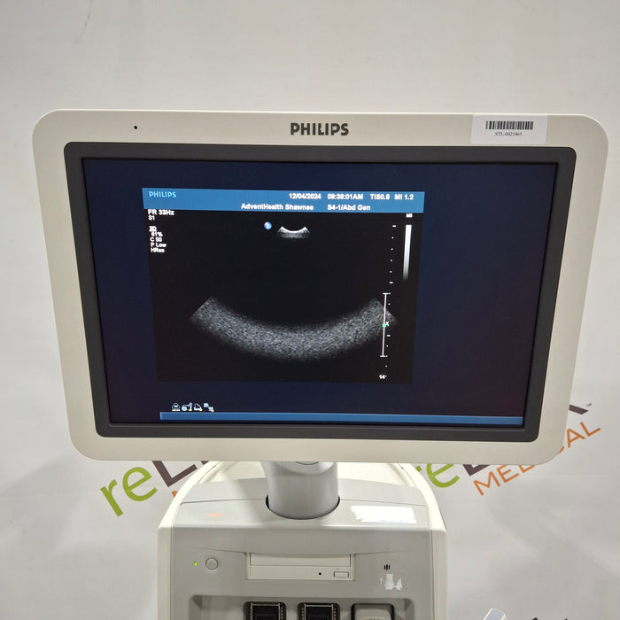 Philips IU22 Ultrasound