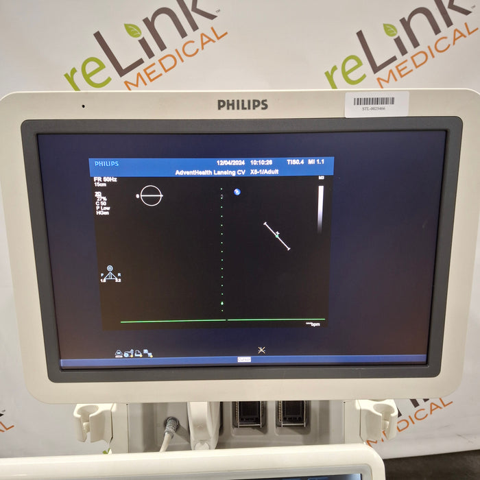 Philips IE33 F-G Cart Ultrasound