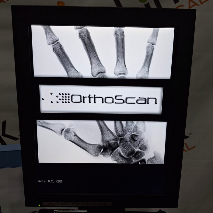 Orthoscan HD 1000-0001 Mini C-Arm