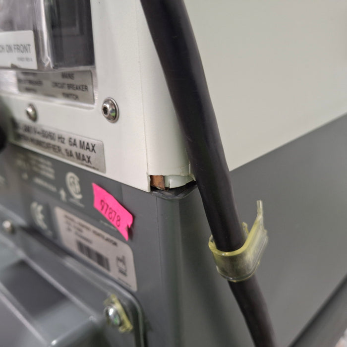 Respironics Esprit Ventilator