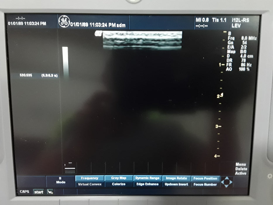 GE Healthcare GE Healthcare Logiq Book XP Portable Ultrasound Ultrasound reLink Medical