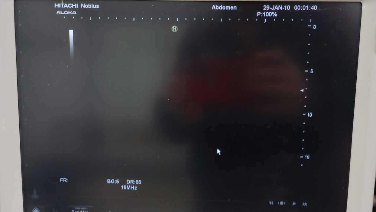 Hitachi Hitachi Noblus Ultrasound Ultrasound reLink Medical