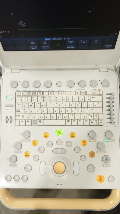 Philips CX50 Ultrasound