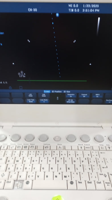 Philips CX50 Ultrasound