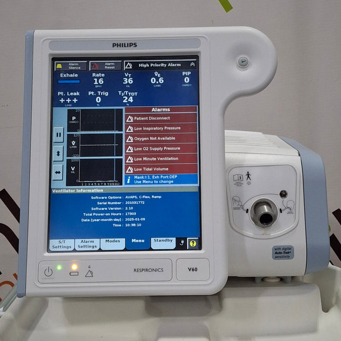 Philips Respironics V60 BiPAP Ventilator