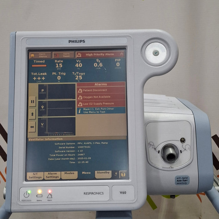 Philips Respironics V60 BiPAP Ventilator