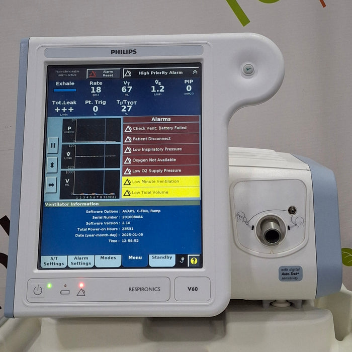 Philips Respironics V60 BiPAP Ventilator