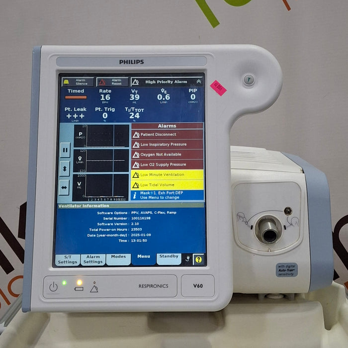 Philips Respironics V60 BiPAP Ventilator