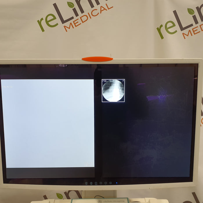 Ziehm Imaging Ziehm Imaging Vision RFD 3D C-Arm C-Arms & Tables reLink Medical