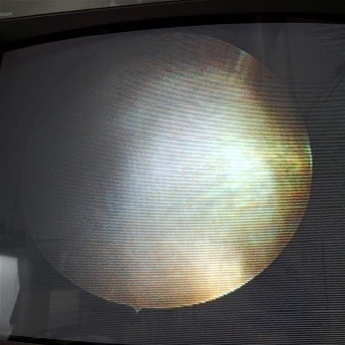 Karl Storz 27005B 4mm 30° Cystoscope