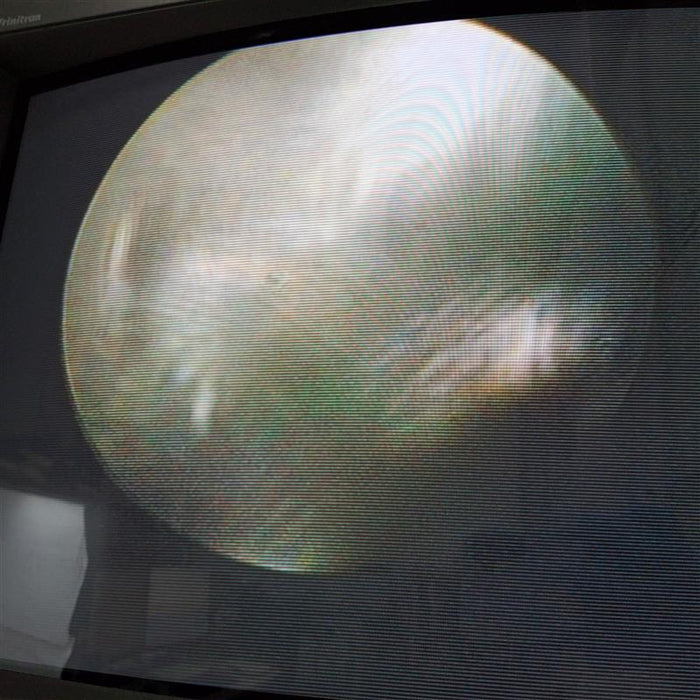 Circon ACMI USA E Rigid Scope