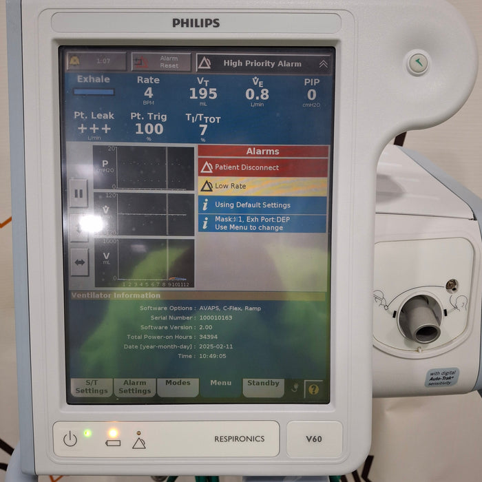 Philips Respironics V60 BiPAP Ventilator