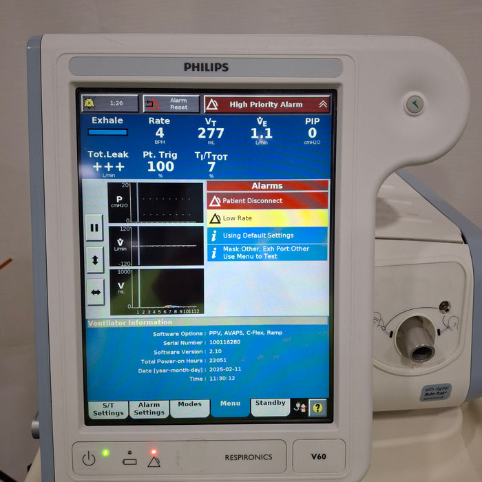 Philips Philips Respironics V60 BiPAP Ventilator Respiratory reLink Medical
