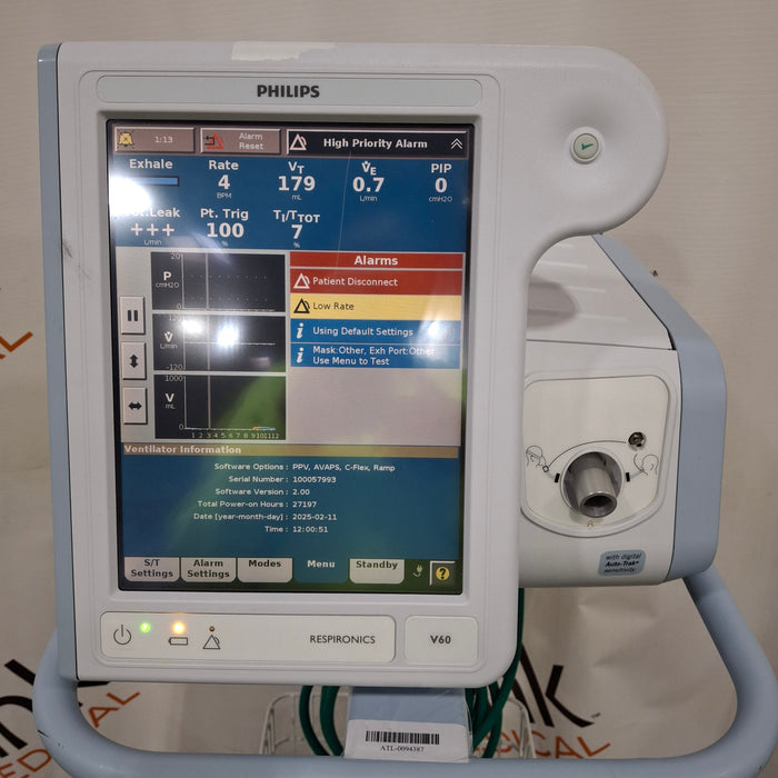 Philips Respironics V60 BiPAP Ventilator