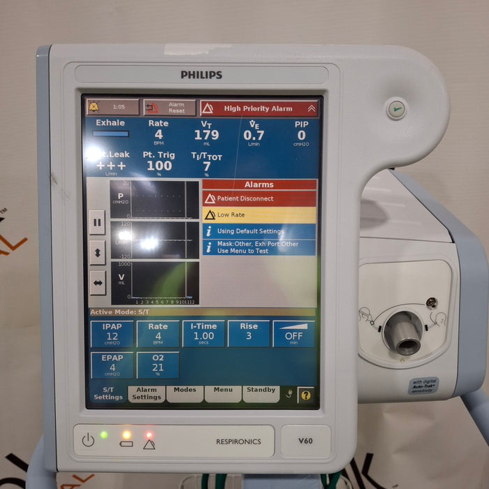 Philips Respironics V60 BiPAP Ventilator