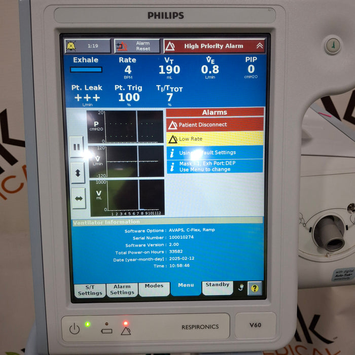 Philips Philips Respironics V60 BiPAP Ventilator Respiratory reLink Medical