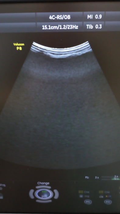 GE Healthcare GE Healthcare Voluson P8 Ultrasound Ultrasound reLink Medical