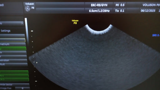 GE Healthcare GE Healthcare Voluson P8 Ultrasound Ultrasound reLink Medical